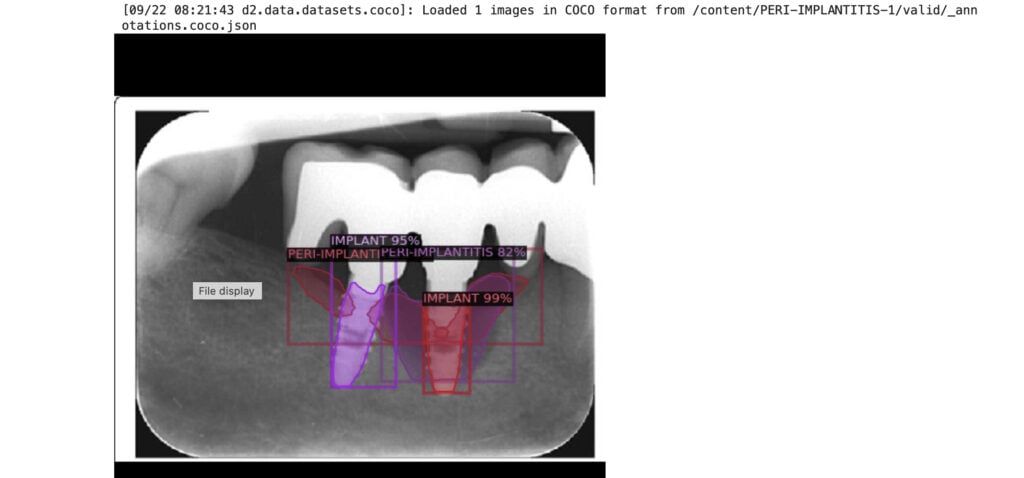 AI in Dentistry: AI สำหรับงานทันตกรรม เพิ่มคุณภาพบริการ