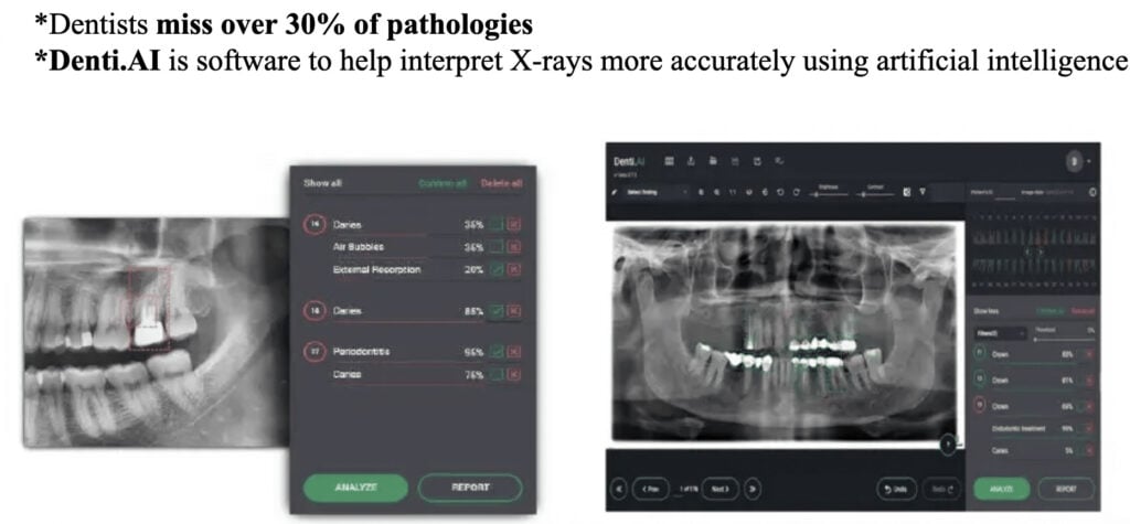 AI in Dentistry: AI สำหรับงานทันตกรรม เพิ่มคุณภาพบริการ
